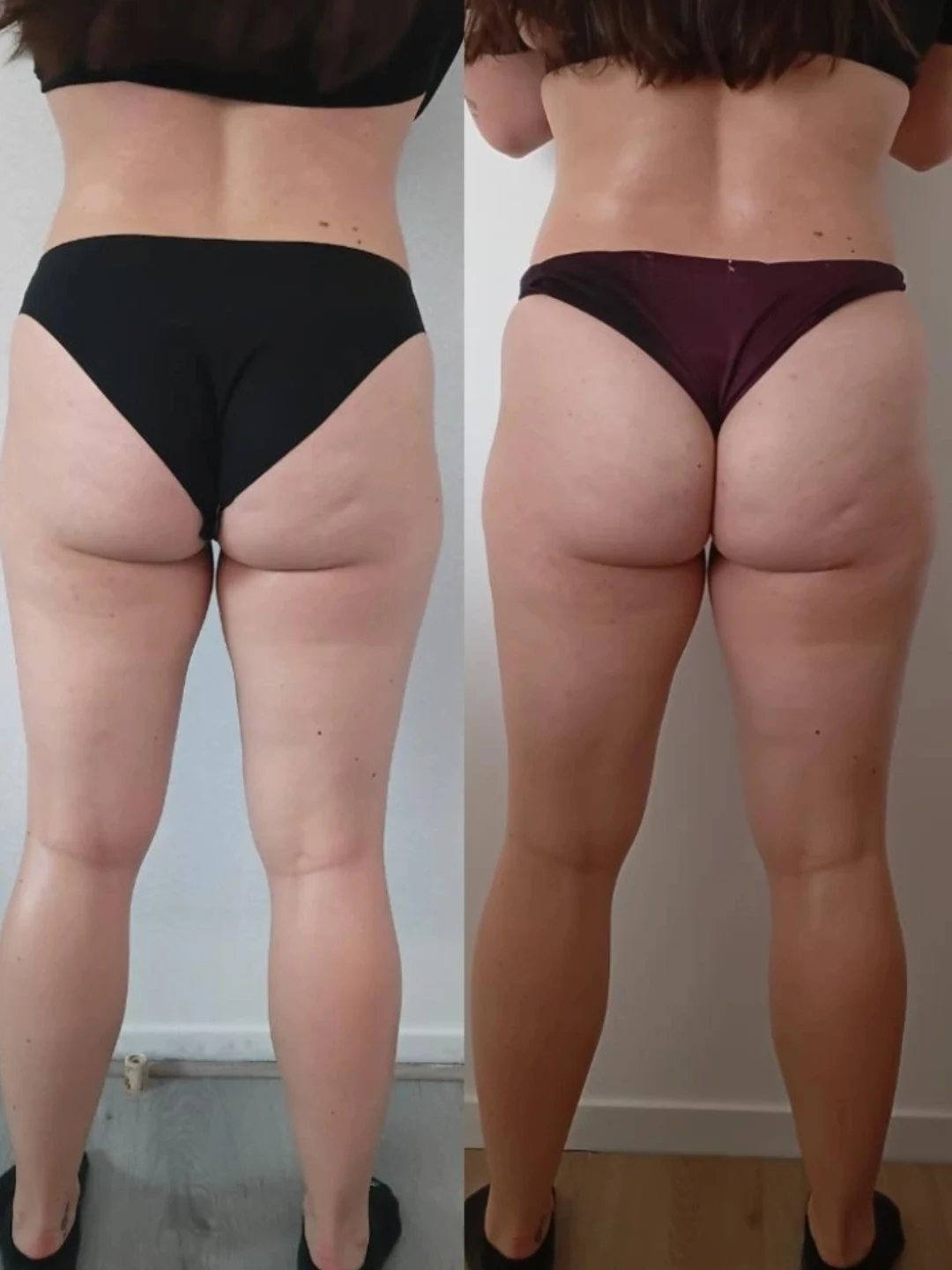 Après - Massage remodelant